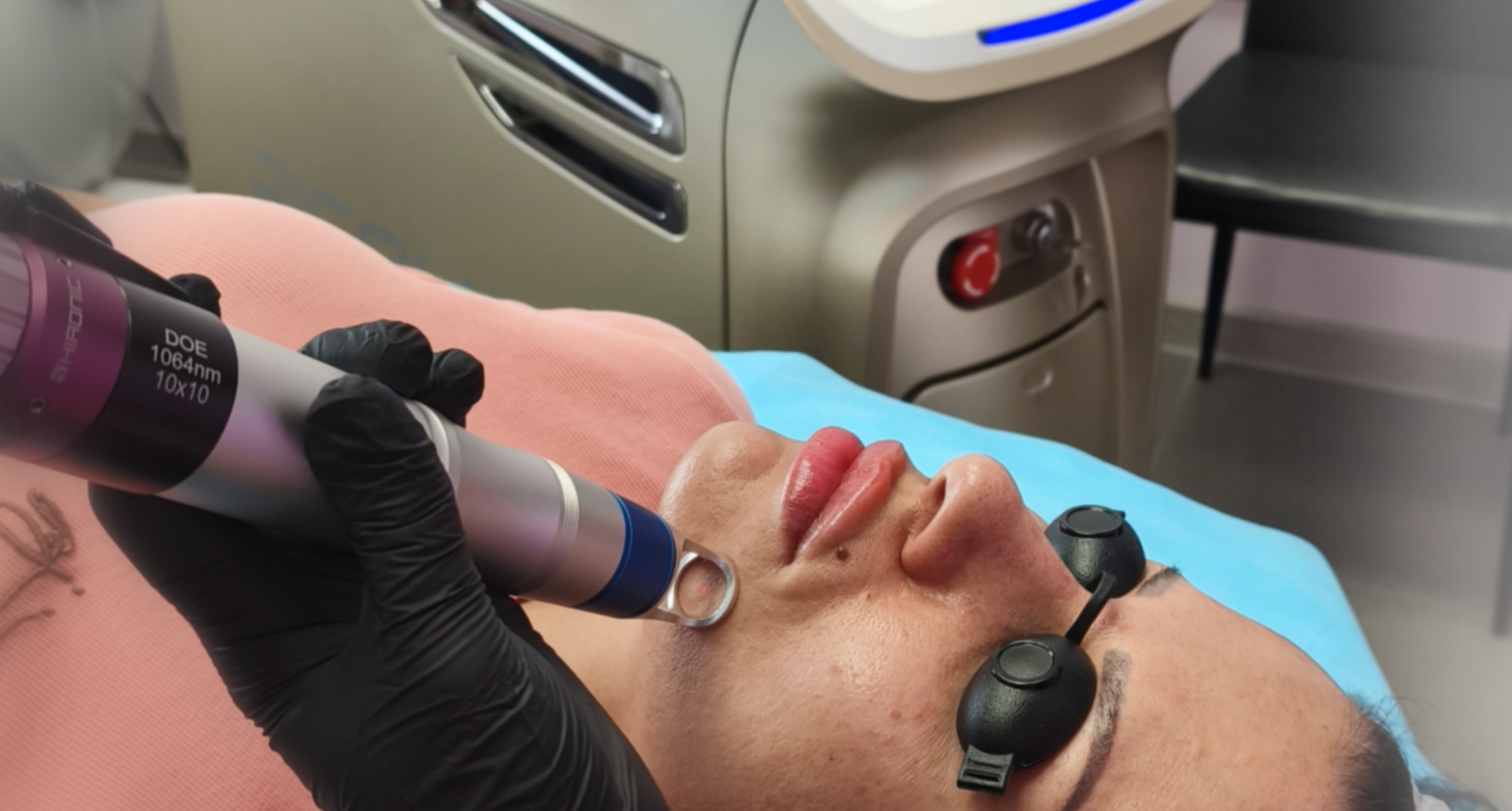 Лазерно подмладяване с PicoHI – Адара Русе